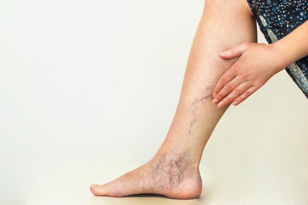 Illustration of Vein Structure